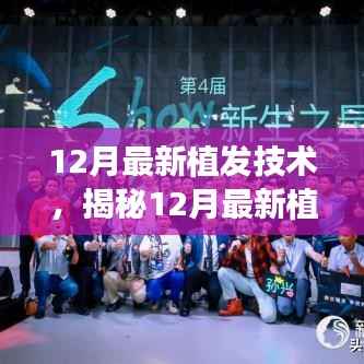 揭秘,最新植发技术重塑自信三大要点,重塑你的自信风采