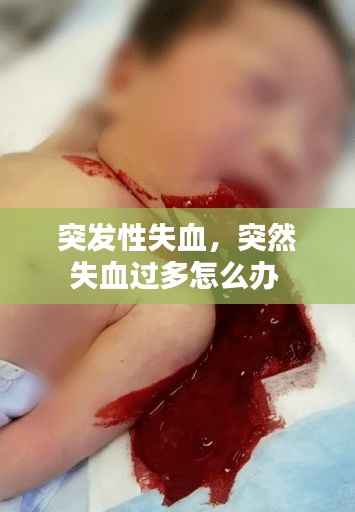 突发性失血,突然失血过多怎么办