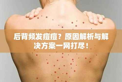 后背频发痘痘？原因解析与解决方案一网打尽！