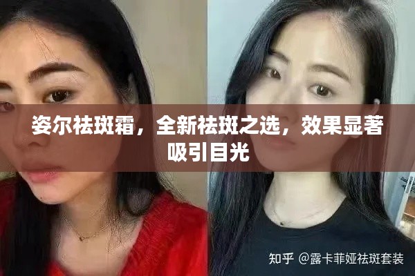姿尔祛斑霜,全新祛斑之选,效果显著吸引目光