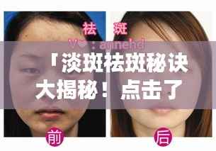 「淡斑祛斑秘诀大揭秘!点击了解百度推荐的最佳方法」