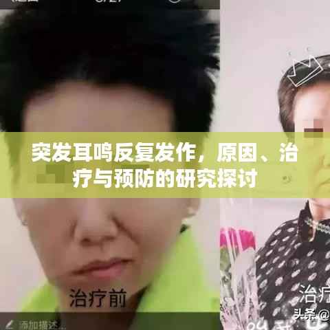 突发耳鸣反复发作,原因、治疗与预防的研究探讨