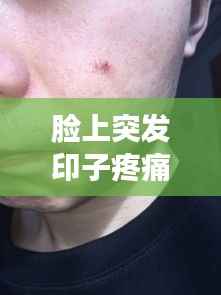 脸上突发印子疼痛原因何在?皮肤问题成因解析与应对方法!